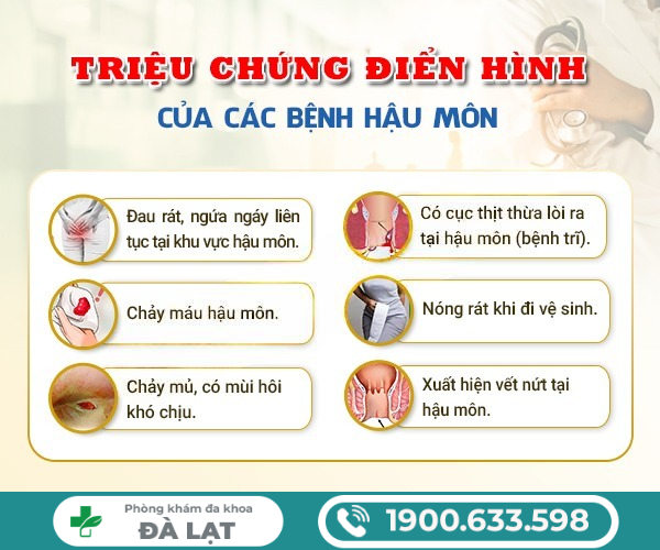 Hình ảnh minh họa